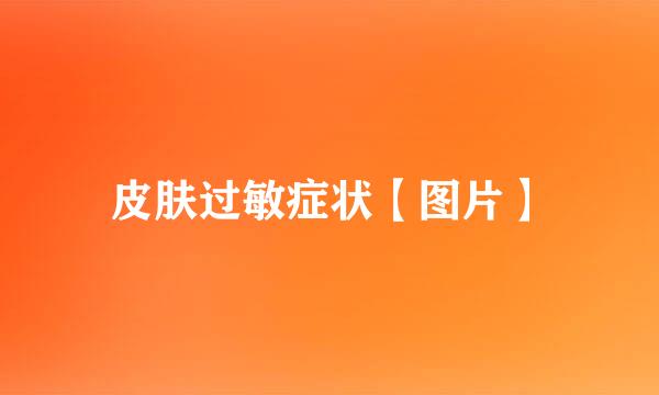 皮肤过敏症状【图片】