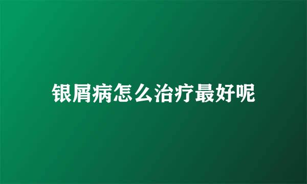 银屑病怎么治疗最好呢