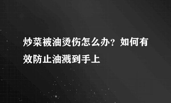 炒菜被油烫伤怎么办？如何有效防止油溅到手上