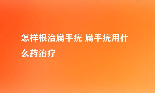 怎样根治扁平疣 扁平疣用什么药治疗