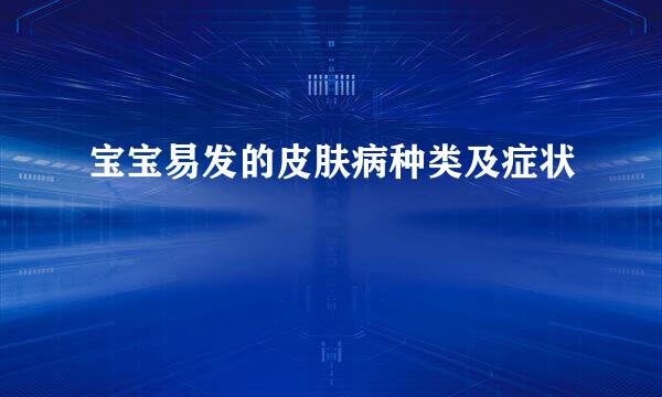 宝宝易发的皮肤病种类及症状