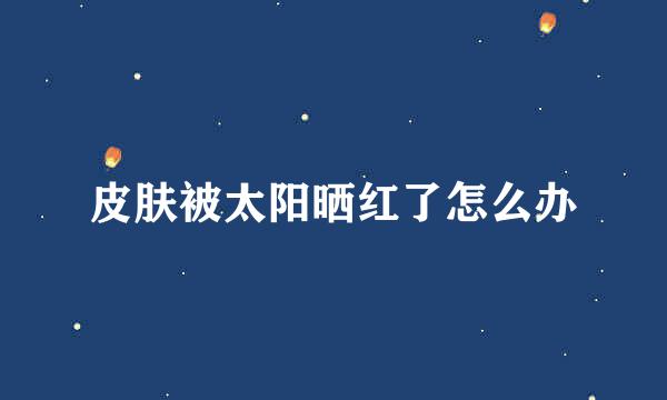 皮肤被太阳晒红了怎么办