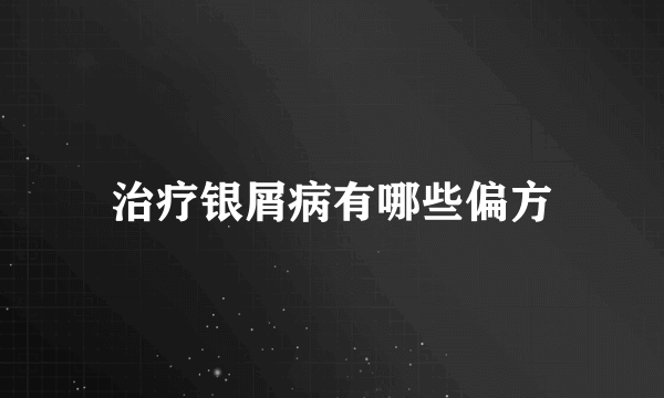 治疗银屑病有哪些偏方