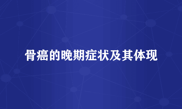 骨癌的晚期症状及其体现