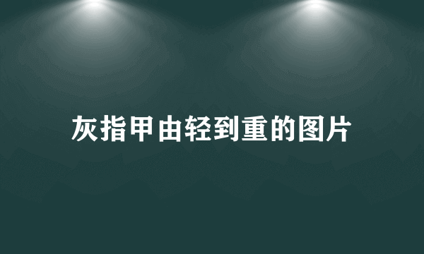 灰指甲由轻到重的图片