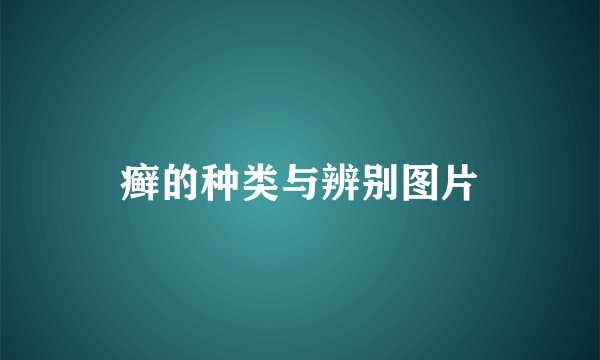 癣的种类与辨别图片