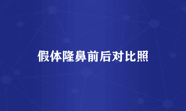 假体隆鼻前后对比照