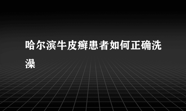 哈尔滨牛皮癣患者如何正确洗澡